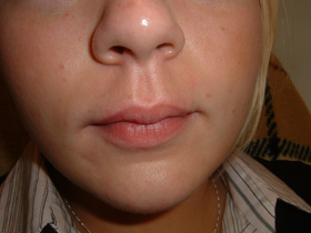 lips before